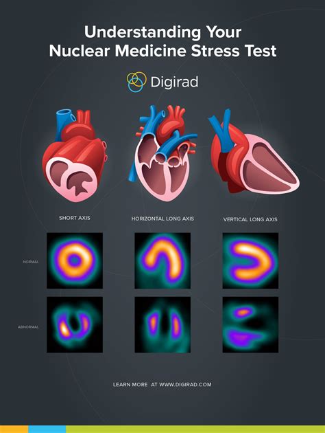 is nuclear stress test hard on kidneys|nuclear stress test radiology.